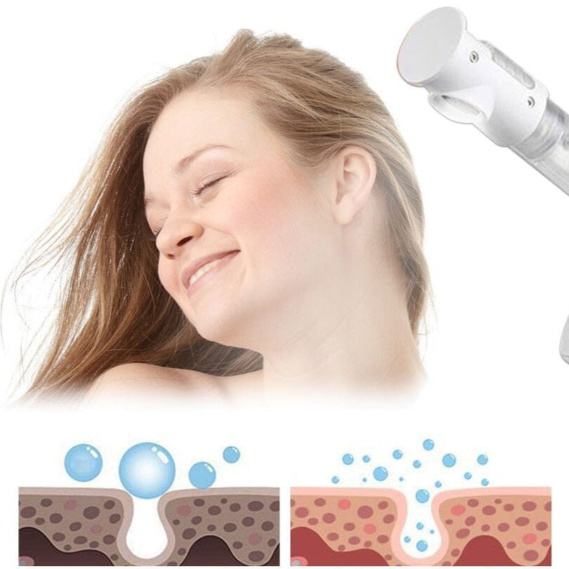 Vaporizador de Ozônio Para Pele e Cabelo Vaporizador Ozônio Pele e Cabelo Superfacilita 